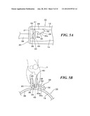 HOSE CLAMP diagram and image