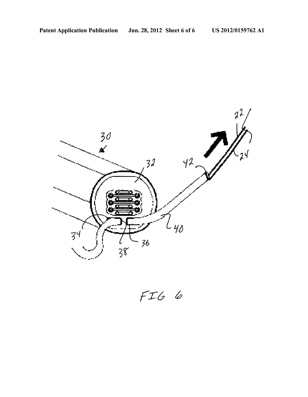 METHOD AND APPARATUS FOR INSTALLING A RACQUET SAFETY CORD - diagram, schematic, and image 07