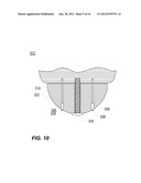 METHOD OF USING GRASS TRIMMING APPARATUS WITH SPINNING SUPPORT GUIDE diagram and image