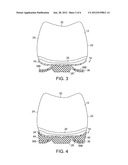 ARTICLE OF FOOTWEAR WITH FOREFOOT PLATES diagram and image