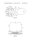 ARTICLE OF FOOTWEAR WITH FOREFOOT PLATES diagram and image