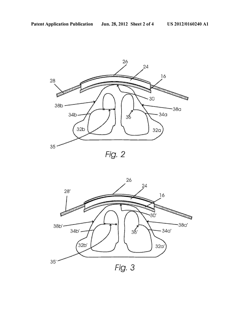 DILATED NASAL SLEEP MASK - diagram, schematic, and image 03