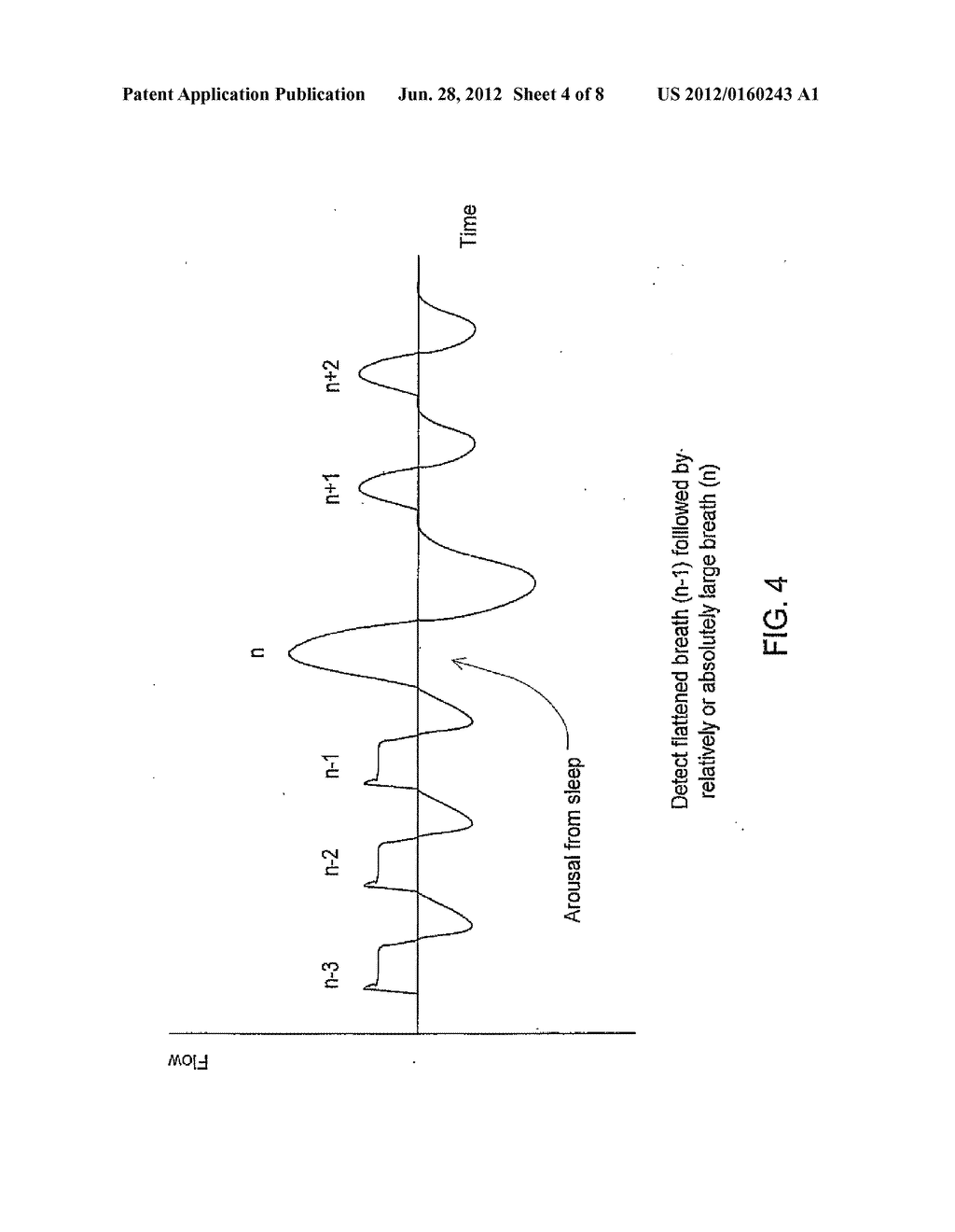 MACRO-CONTROL OF TREATMENT FOR SLEEP DISORDERED BREATHING - diagram, schematic, and image 05