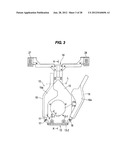 ELECTROPLATING METHOD diagram and image