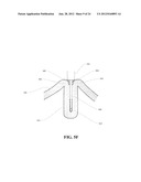 METHODS AND DEVICES FOR REDUCING GASTRIC VOLUME diagram and image