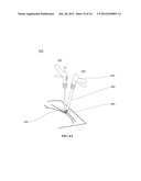 METHODS AND DEVICES FOR REDUCING GASTRIC VOLUME diagram and image