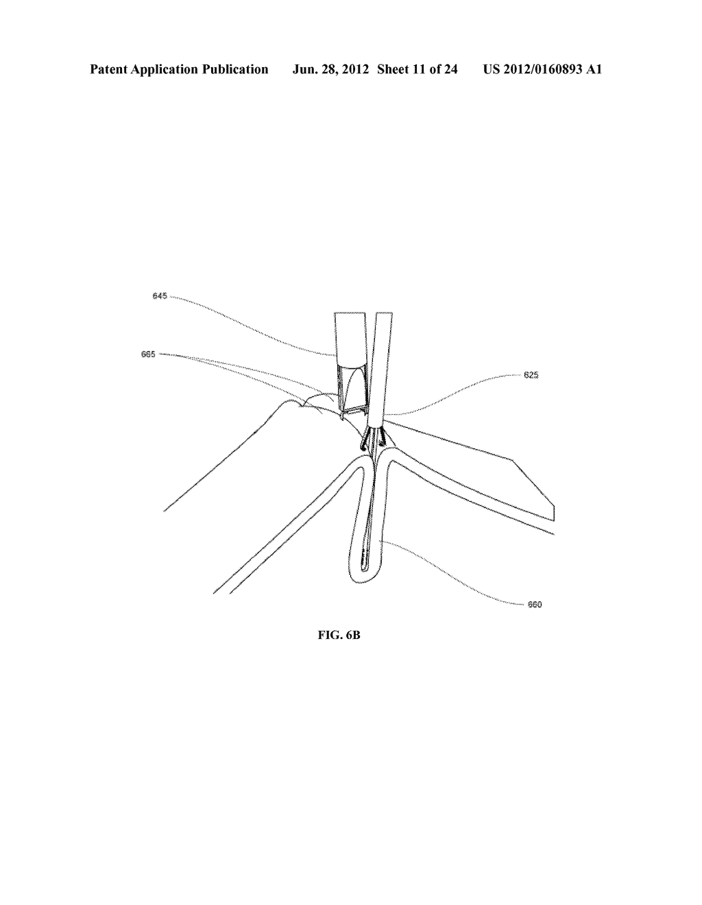 METHODS AND DEVICES FOR REDUCING GASTRIC VOLUME - diagram, schematic, and image 12