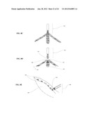 METHODS AND DEVICES FOR REDUCING GASTRIC VOLUME diagram and image