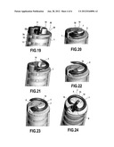 FASTENER FOR MECHANICAL SUTURE diagram and image