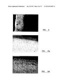 Electrode diagram and image