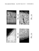 Electrode diagram and image