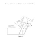 Media Sheet Stacking Implement diagram and image