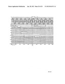 SINGLE-PHASE VOLTAGE SOURCE AC/DC CONVERTER AND INTERCONNECTION SYSTEM diagram and image