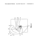 EARPIECE POSITIONING AND RETAINING diagram and image