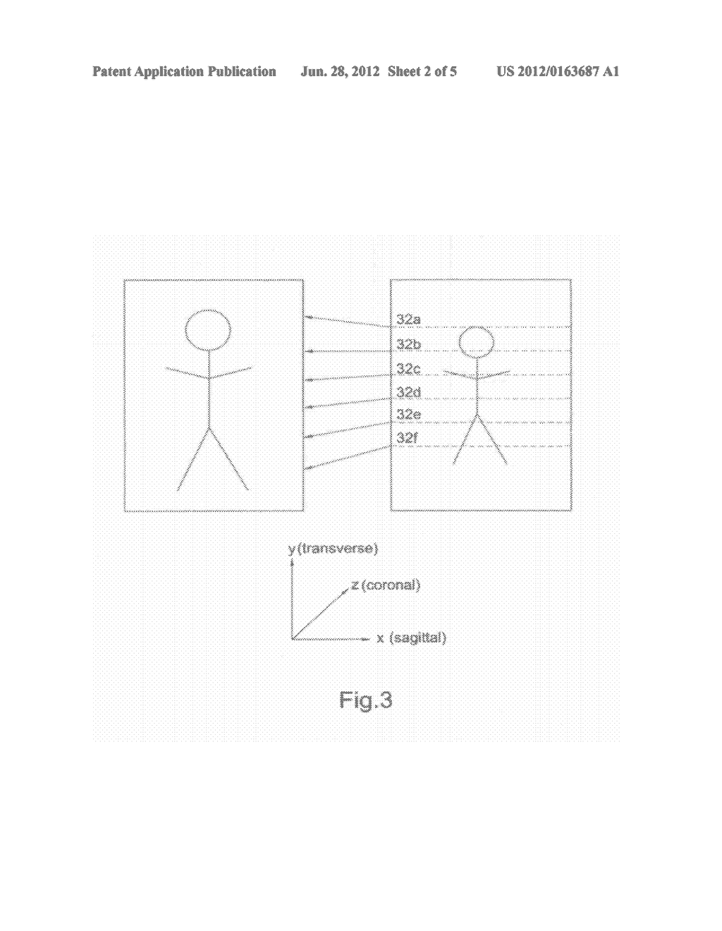 FEATURE LOCATION METHOD AND SYSTEM - diagram, schematic, and image 03