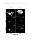 TIME-DOMAIN ESTIMATOR FOR IMAGE RECONSTRUCTION diagram and image