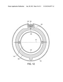 FAN diagram and image