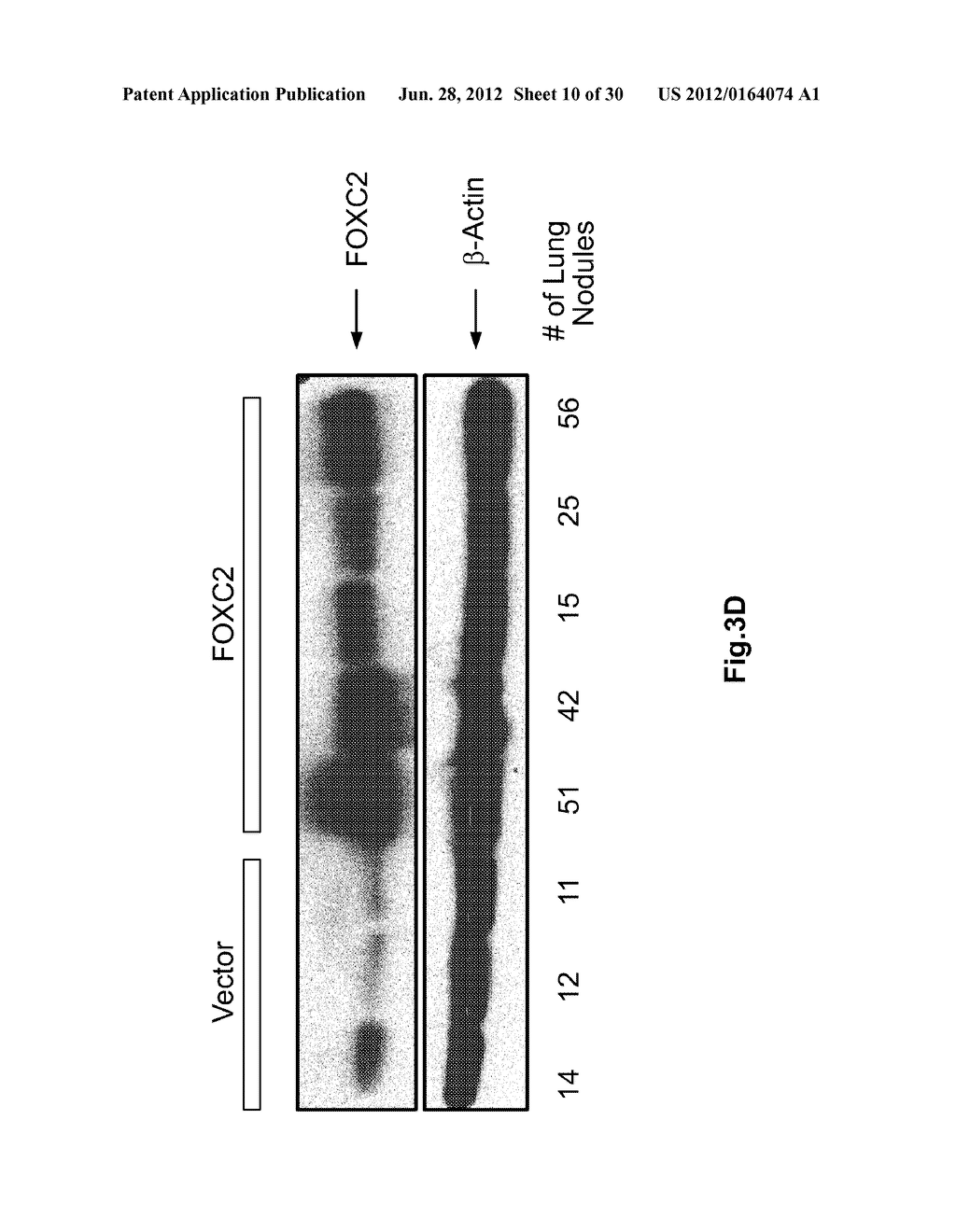 METHODS OF DIAGNOSING, PREVENTING AND TREATING CANCER METASTASIS - diagram, schematic, and image 11