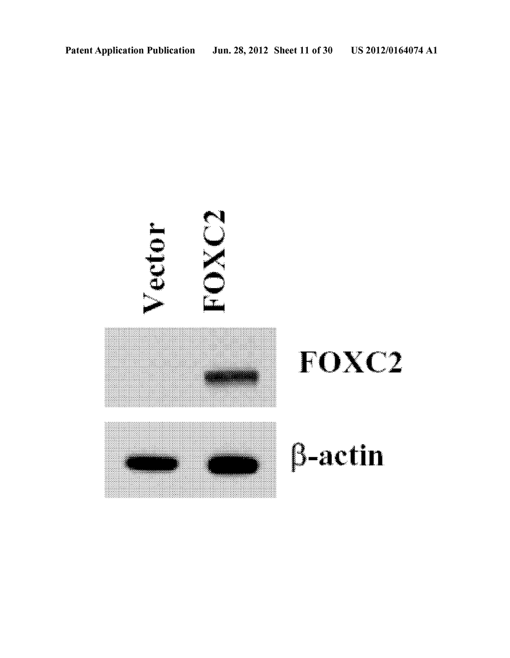 METHODS OF DIAGNOSING, PREVENTING AND TREATING CANCER METASTASIS - diagram, schematic, and image 12