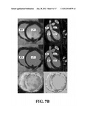 IMAGING OF BIOLOGICAL TISSUE UTILIZING NANOPARTICLES diagram and image