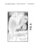 IMAGING OF BIOLOGICAL TISSUE UTILIZING NANOPARTICLES diagram and image