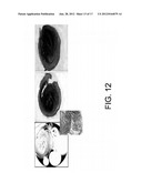 IMAGING OF BIOLOGICAL TISSUE UTILIZING NANOPARTICLES diagram and image