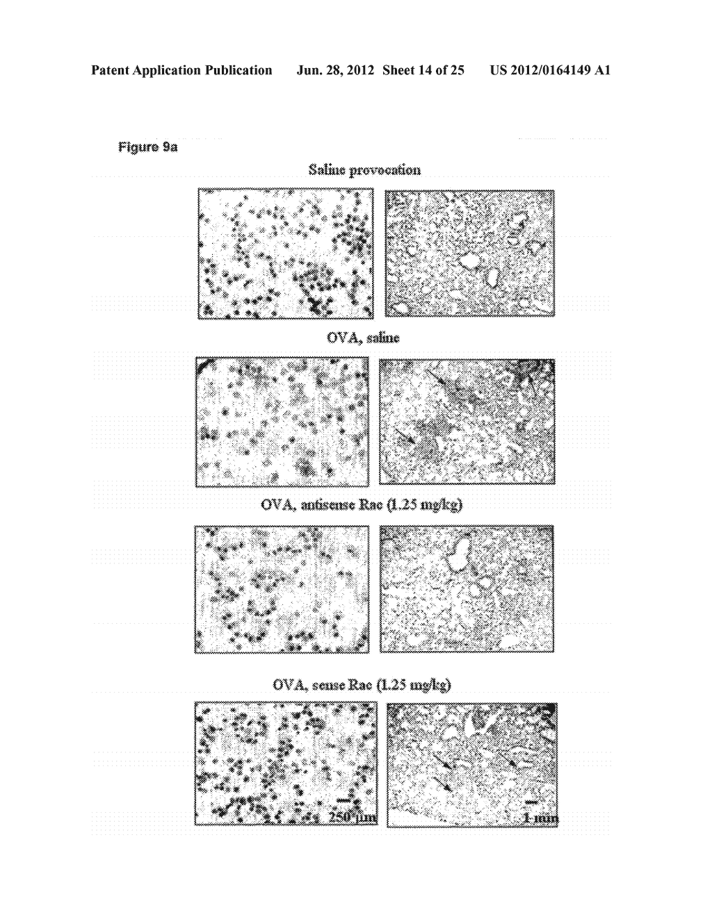 USE OF INHIBITORS OF LEUKOTRIENE B4 RECEPTOR BLT2 FOR TREATING ASTHMA - diagram, schematic, and image 15