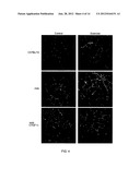 Methods for Treatment of Muscular Dystrophy diagram and image