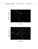 Methods for Treatment of Muscular Dystrophy diagram and image