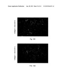 Methods for Treatment of Muscular Dystrophy diagram and image