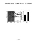 METHOD FOR INCREASING INSULIN SENSITIVITY AND FOR TREATING AND PREVENTING     TYPE 2 DIABETES diagram and image