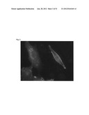 MONOCLONAL ANTIBODIES AGAINST CLAUDIN-18 FOR TREATMENT OF CANCER diagram and image