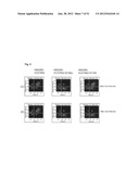 MONOCLONAL ANTIBODIES AGAINST CLAUDIN-18 FOR TREATMENT OF CANCER diagram and image