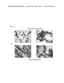 MONOCLONAL ANTIBODIES AGAINST CLAUDIN-18 FOR TREATMENT OF CANCER diagram and image