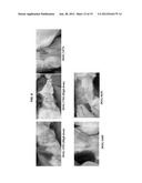 Leishmania Challenge Model diagram and image