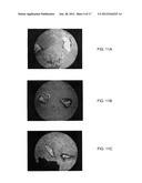 BONE GRAFT MATERIALS AND METHODS diagram and image