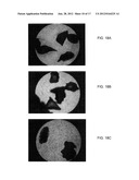 BONE GRAFT MATERIALS AND METHODS diagram and image