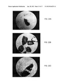 BONE GRAFT MATERIALS AND METHODS diagram and image