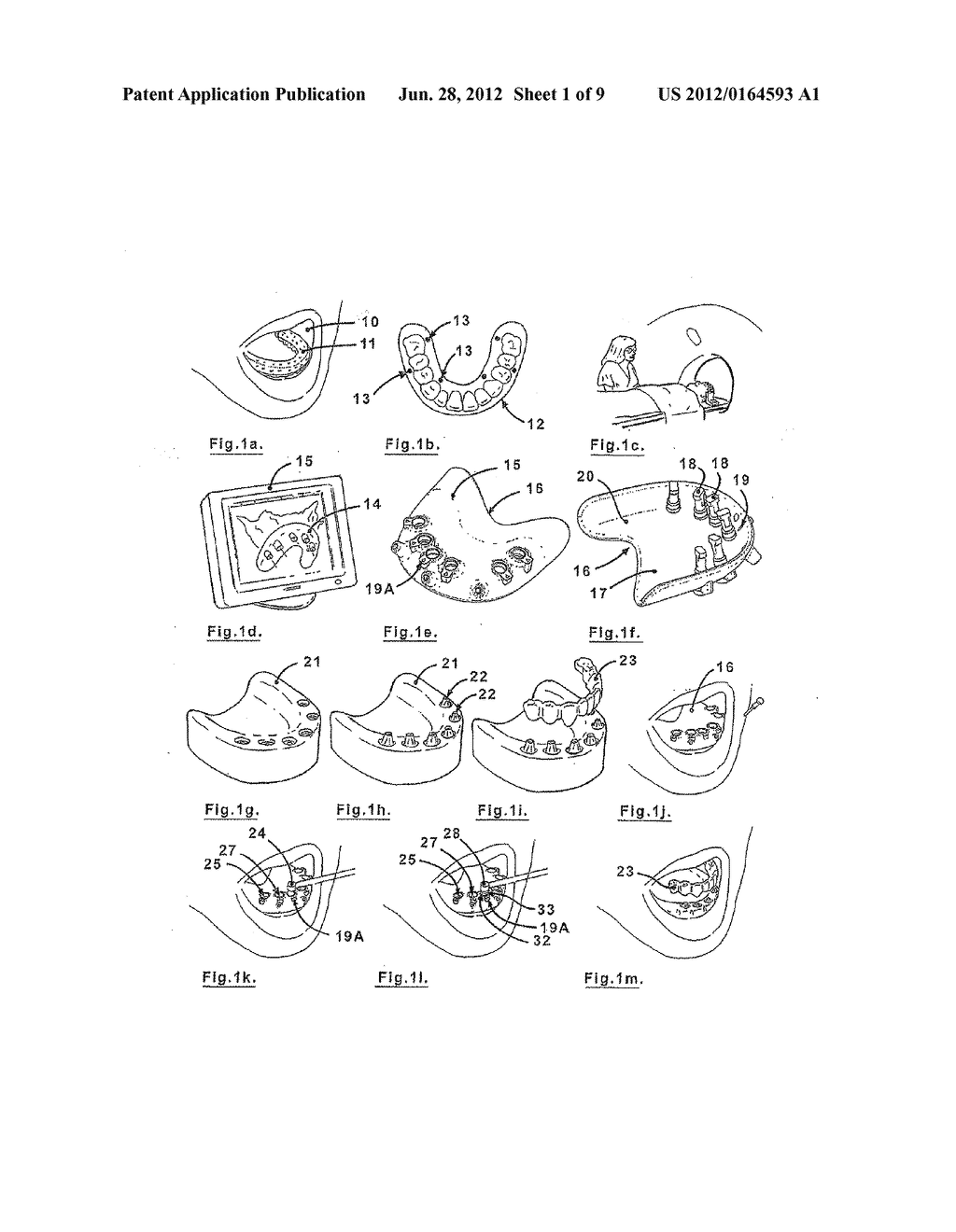 SURGICAL DRILL GUIDE AND INDEX SYSTEM - diagram, schematic, and image 02