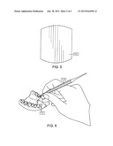 DENTAL FULCRUM diagram and image