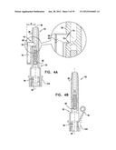 DENTAL IMPLEMENT HAVING LUMEN AND DISTAL THREADING diagram and image