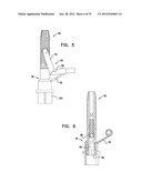 DENTAL IMPLEMENT HAVING LUMEN AND DISTAL THREADING diagram and image