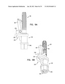 DENTAL IMPLEMENT HAVING LUMEN AND DISTAL THREADING diagram and image