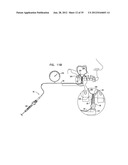 DENTAL IMPLEMENT HAVING LUMEN AND DISTAL THREADING diagram and image