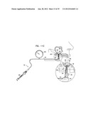 DENTAL IMPLEMENT HAVING LUMEN AND DISTAL THREADING diagram and image