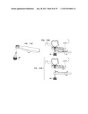 DENTAL IMPLEMENT HAVING LUMEN AND DISTAL THREADING diagram and image