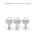 DENTAL IMPLEMENT HAVING LUMEN AND DISTAL THREADING diagram and image