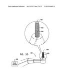 DENTAL IMPLEMENT HAVING LUMEN AND DISTAL THREADING diagram and image