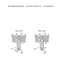 DENTAL IMPLEMENT HAVING LUMEN AND DISTAL THREADING diagram and image