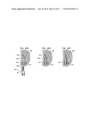 DENTAL IMPLEMENT HAVING LUMEN AND DISTAL THREADING diagram and image